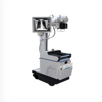 Digital X-ray